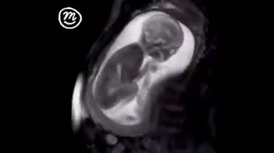 Un feto . Con tan solo 20 semanas de gestación, se mueve, gira la cabeza, da patadas e incluso se pone de pie.Para que los progres digan que no es una vida!!